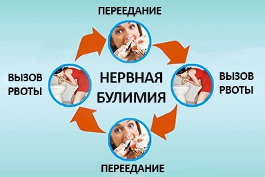 Лечение булимии в Черноголовке